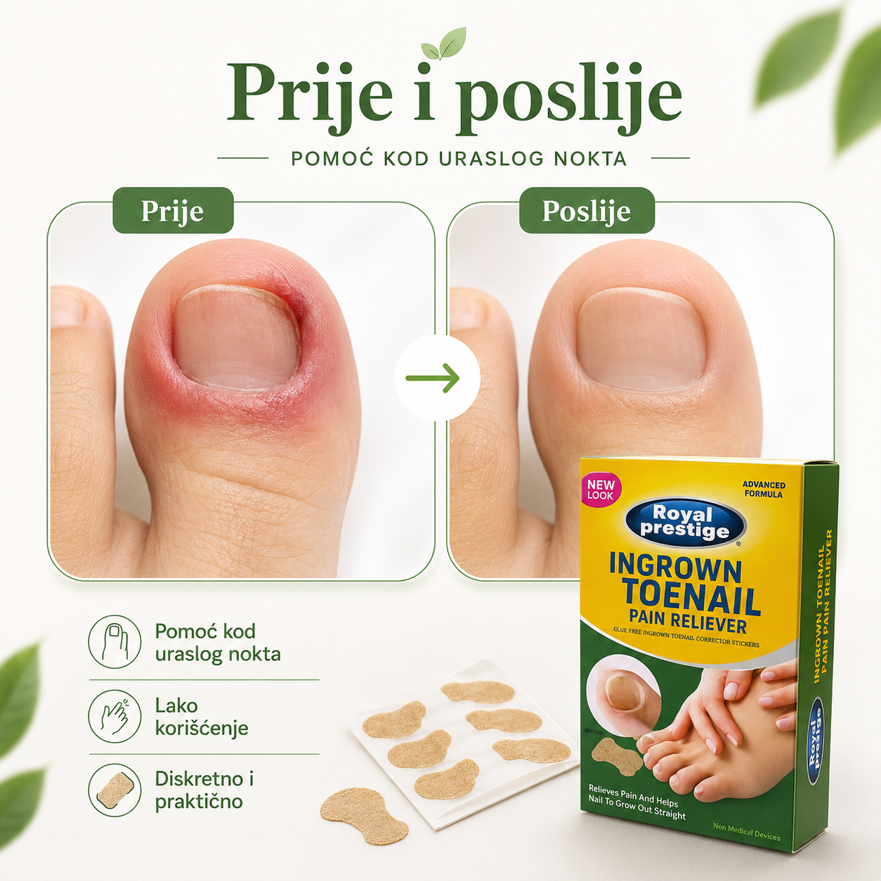 Prirodni flasteri za urasle nokte