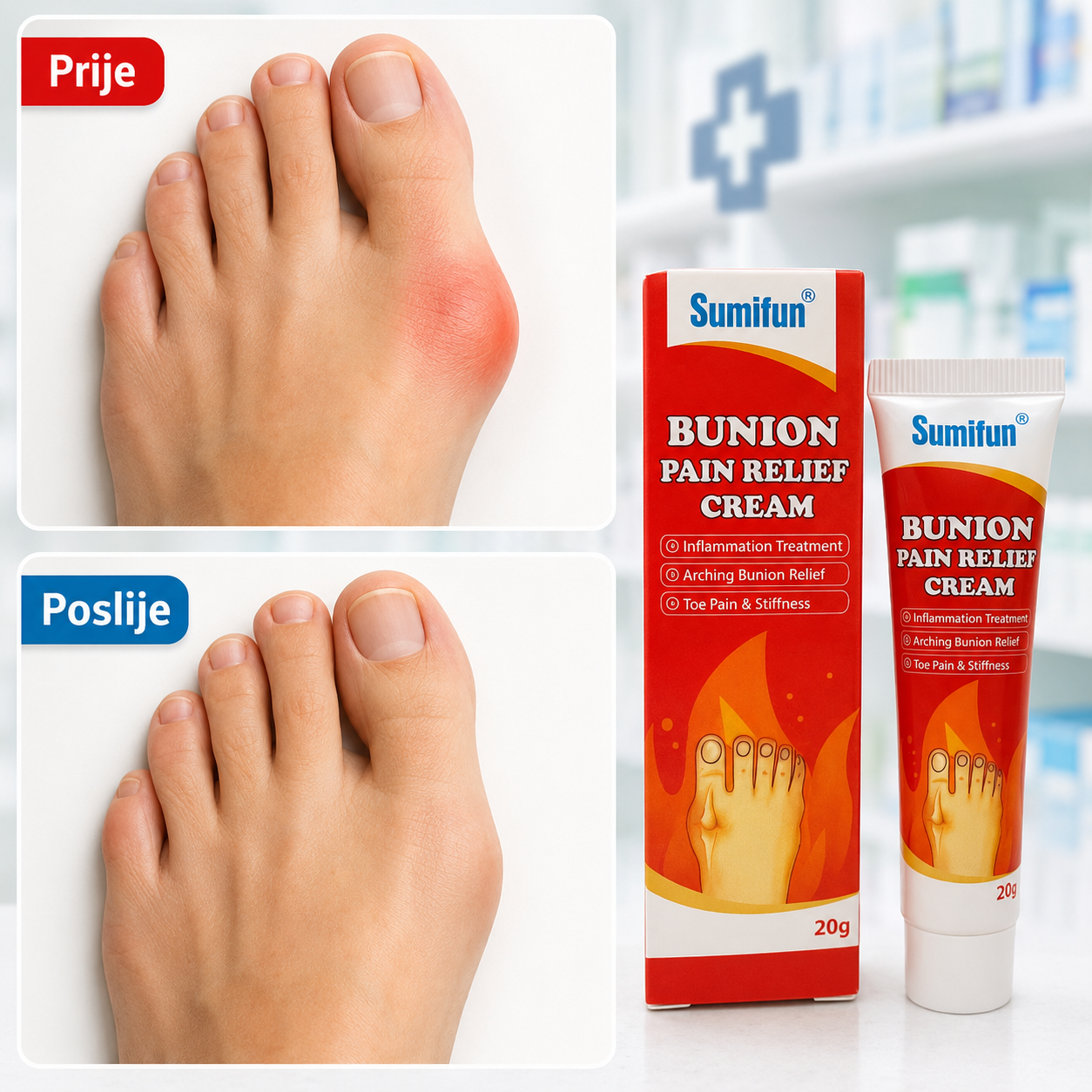 Bunion - Krema za čukljeve