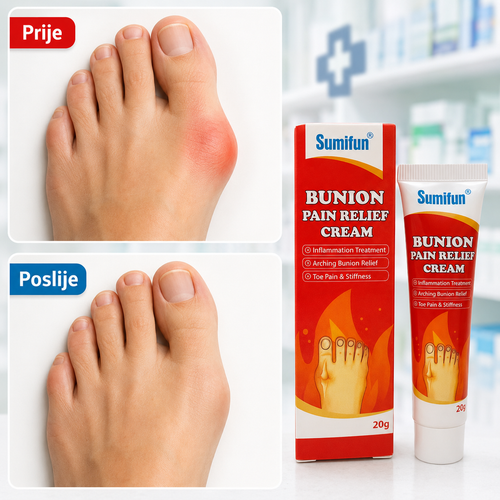 Bunion - Krema za čukljeve
