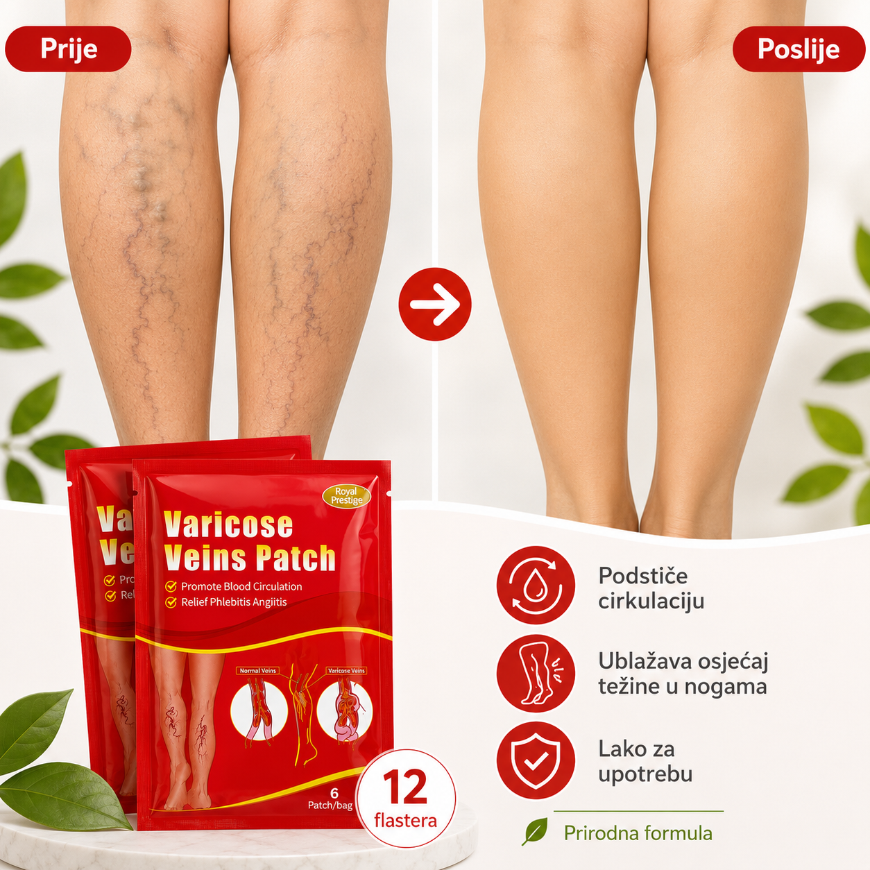 Varicose Veins Patch – flasteri za proširene vene i umorne noge