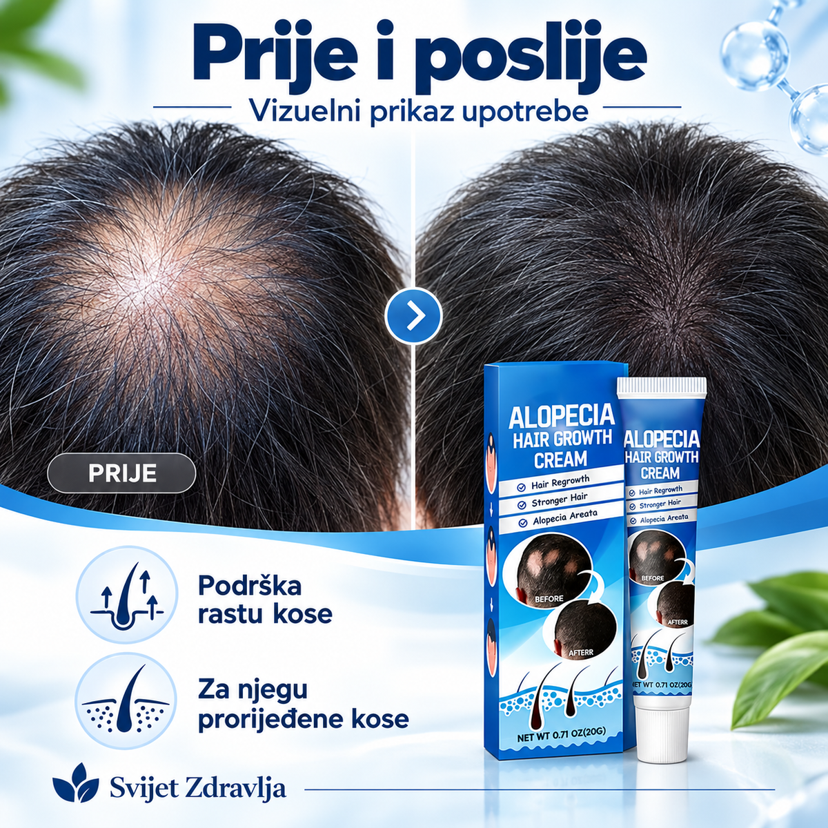 Alopecia Hair – njega za prorijeđenu i oslabljenu kosu