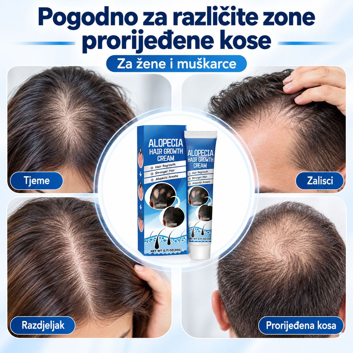 Alopecia Hair – njega za prorijeđenu i oslabljenu kosu