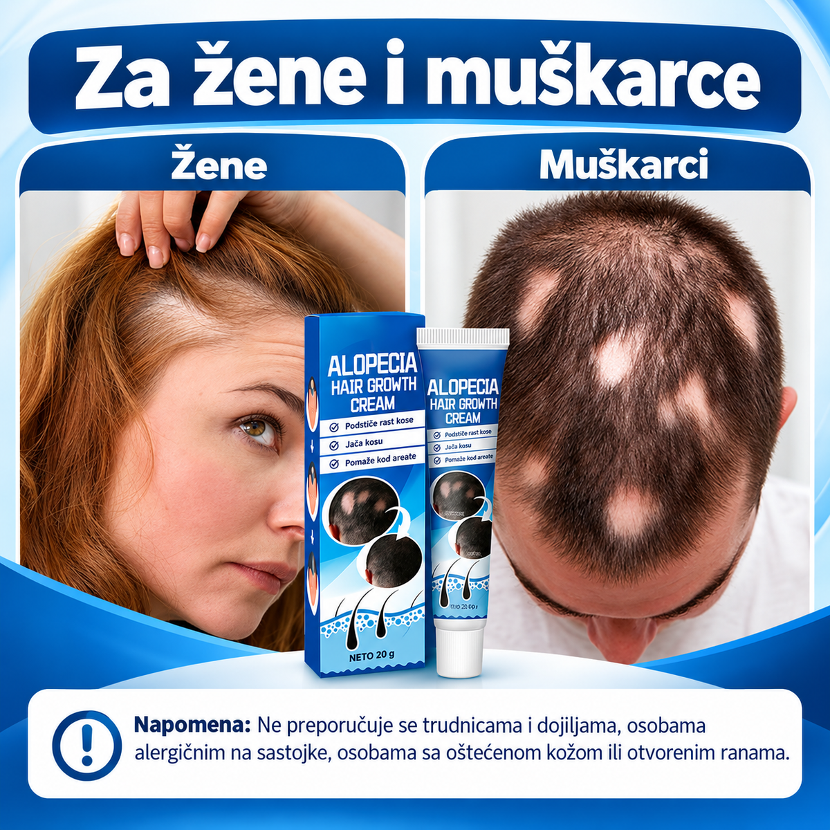 Alopecia Hair – njega za prorijeđenu i oslabljenu kosu